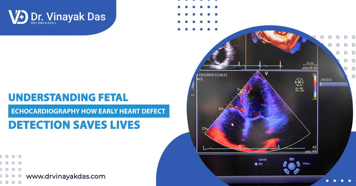 Understanding Fetal Echocardiography: How Early Heart Defect Detection Saves Lives
