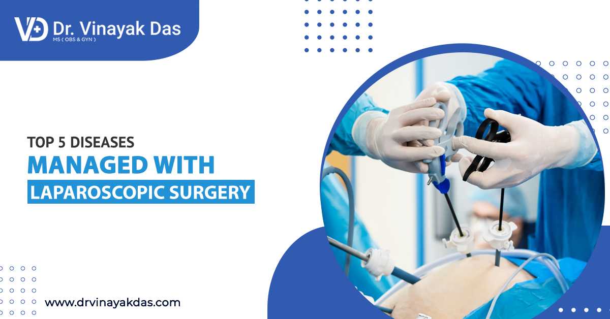 Top 5 Diseases Managed with Laparoscopic Surgery