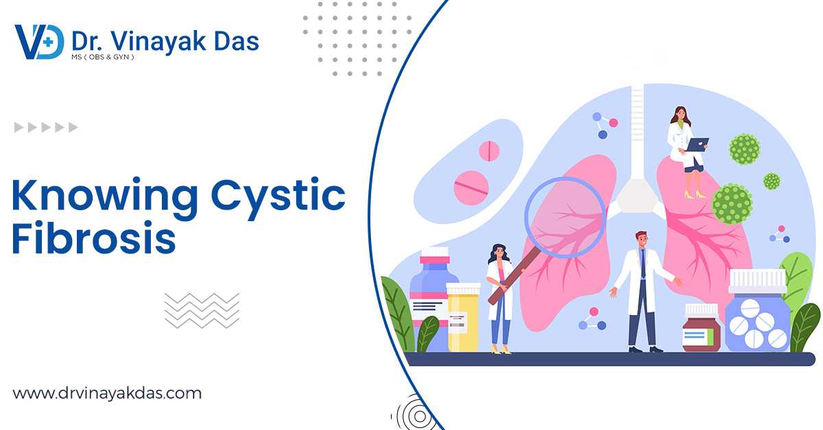 Complications Of Cystic Fibrosis – An Inherited Disorder