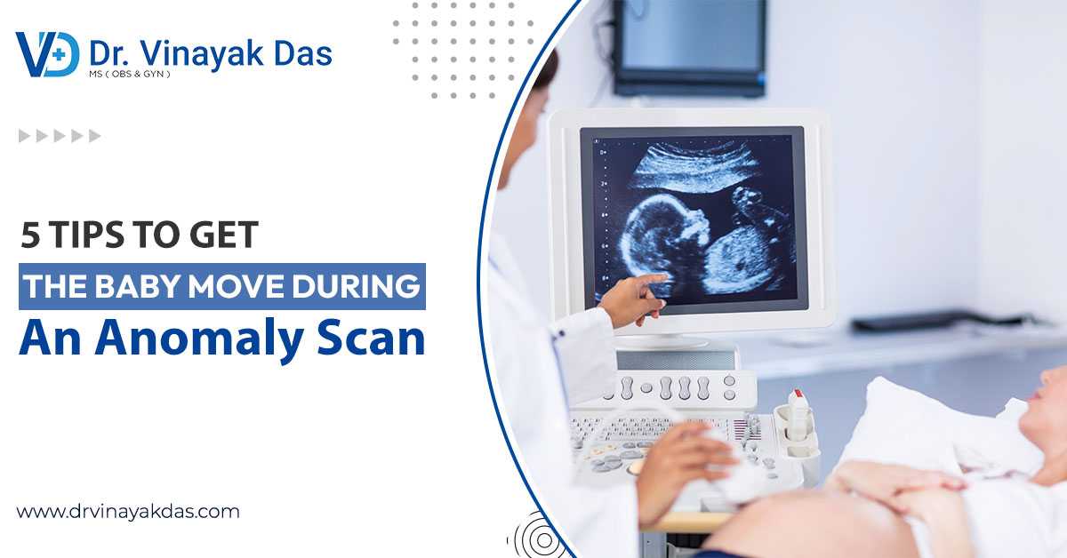 5 Tips To Get The Baby Move During An Anomaly Scan