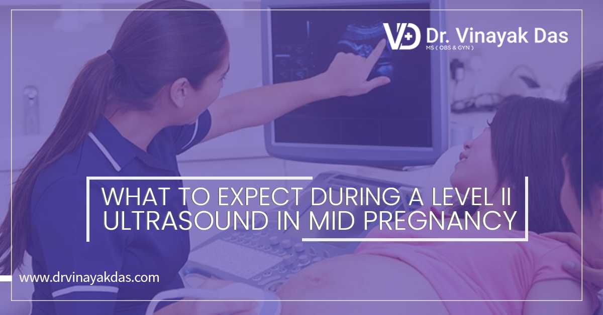 What to Expect During a Level II Ultrasound in Midpregnancy