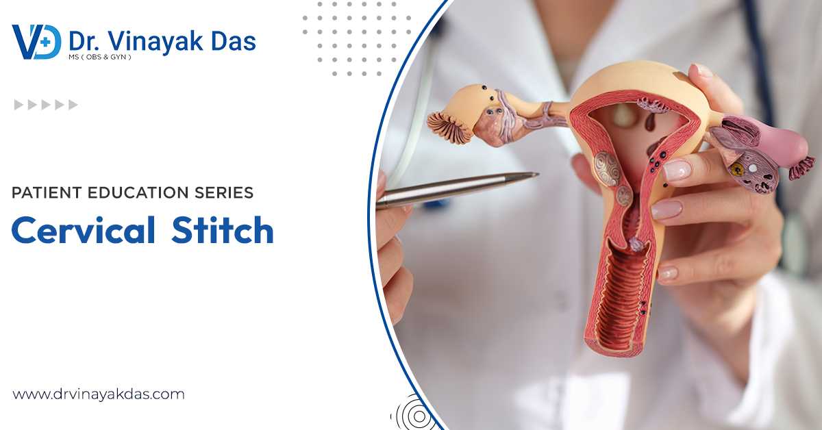 Cervical Stitch