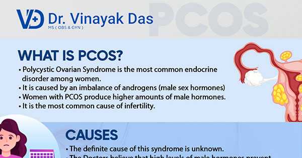 Polycystic Ovary Syndrome (PCOS) Infographics
