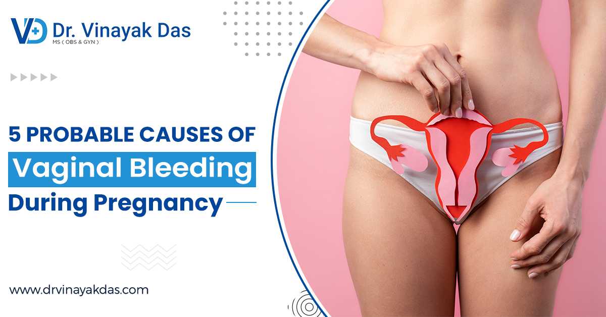 5 Probable Causes Of Vaginal Bleeding During Pregnancy