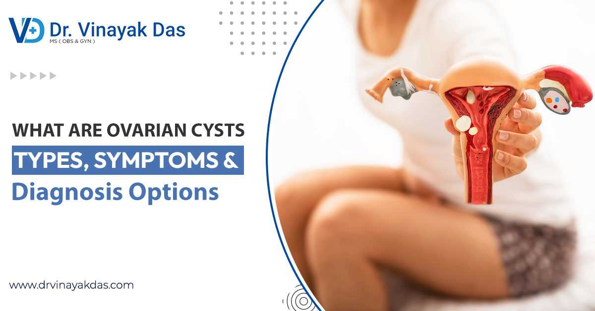 What are Ovarian Cysts? - Types, Symptoms & Diagnosis Options