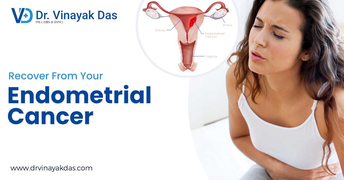 Best Gynae Doctor For Your Endometrial Cancer