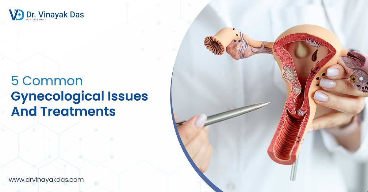 5 Common Gynecological Issues And Treatments