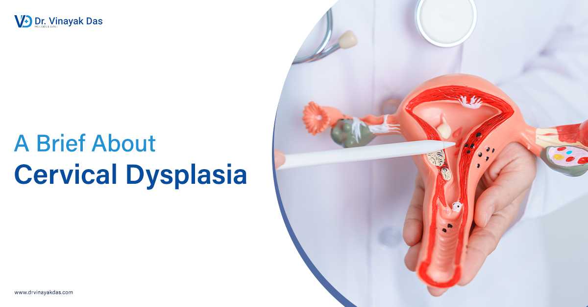 A Brief About Cervical Dysplasia