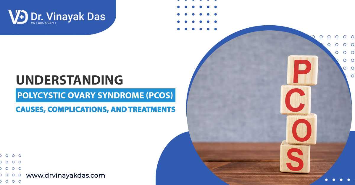 Understanding Polycystic Ovary Syndrome (PCOS): Causes, Complications and Treatments