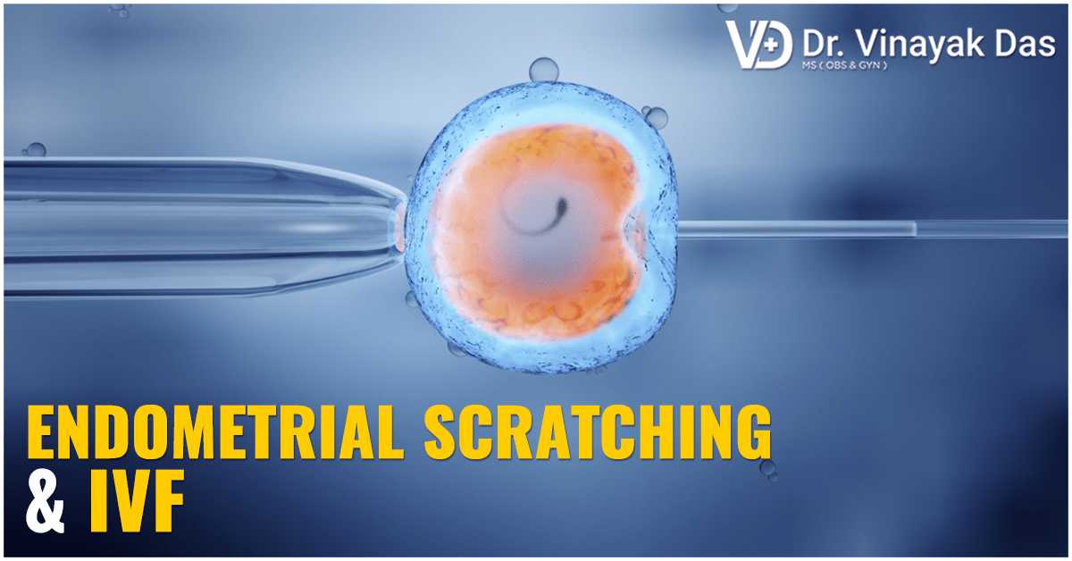 Endometrial Scratching & IVF