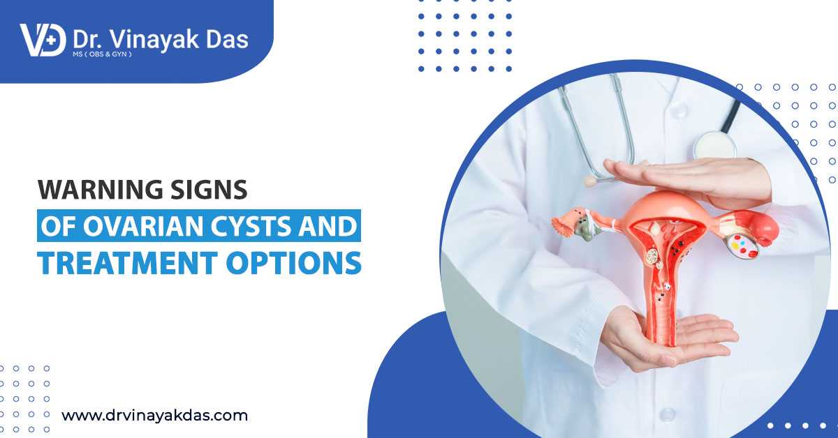 Warning Signs Of Ovarian Cysts And Treatment Options