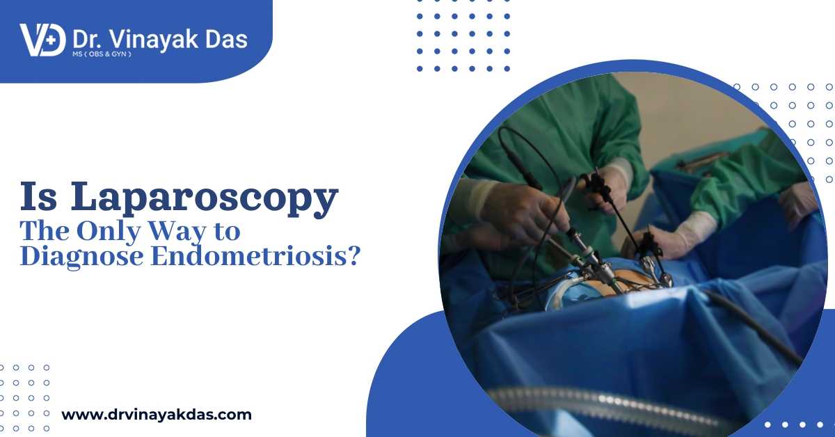 Diagnostic laparoscopy procedure for endometriosis diagnosis by a gynecologist in Siliguri Dr Vinayak Das