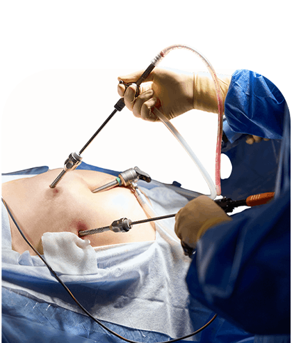 Gynecology Treatment in Siliguri