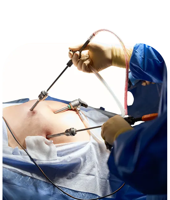 Gynecology Treatment in Siliguri