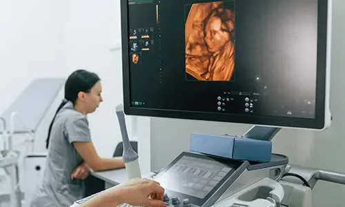 5 Tips To Get The Baby Move During An Anomaly Scan