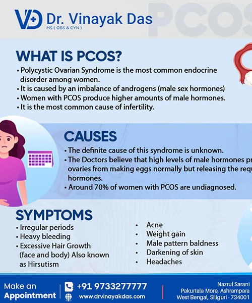 What You Should Know About PCOS