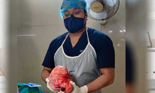 Gynaecological Surgeries