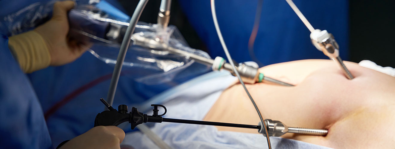 Advanced Laparoscopic Gynae Surgeries - Less Pain, Fast Recovery