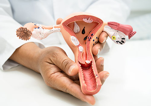 Hysterectomy (Abdominal / Vaginal / Laparoscopic / Robotic)