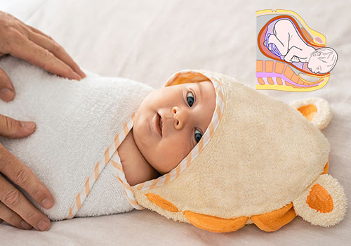 Normal Vaginal Delivery (NVD)