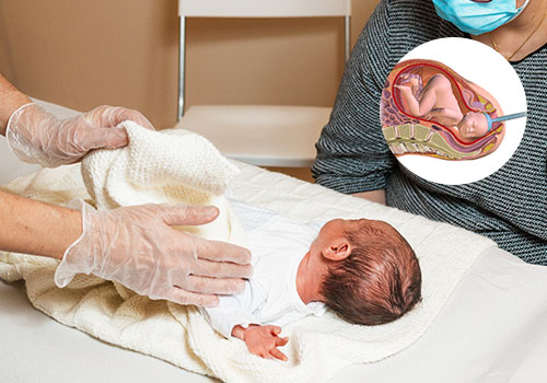 Assisted Vaginal Delivery (Vacuum / Forceps)