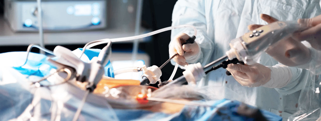 Laparoscopic Ovarian Cystectomy