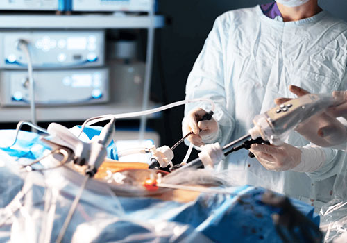 Laparoscopic Ovarian Cystectomy