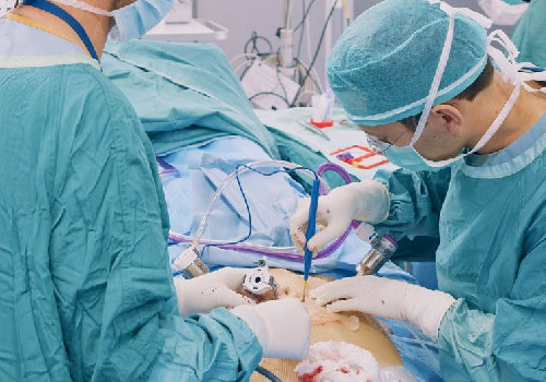 Laparoscopic Myomectomy