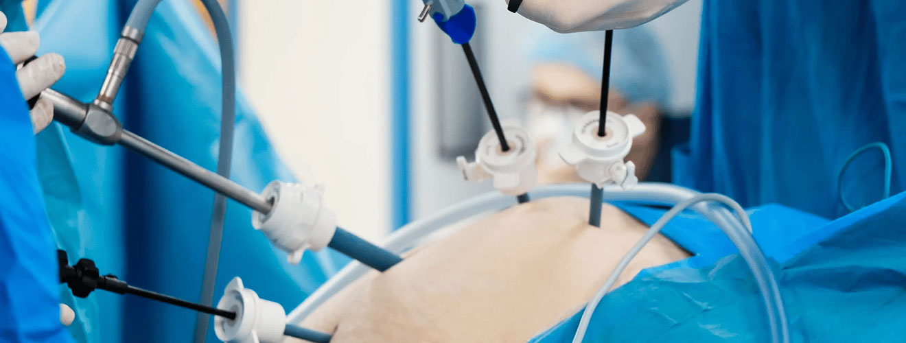 Laparoscopic Hysterectomy